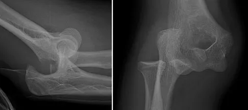 Orthopedic Surgery Board Review 2026 | High-Yield MCQs - Set 8 - Figure 48