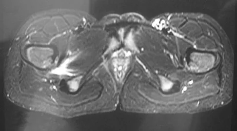 Orthopedic Surgery Board Review 2026 | High-Yield MCQs - Set 8 - Figure 57