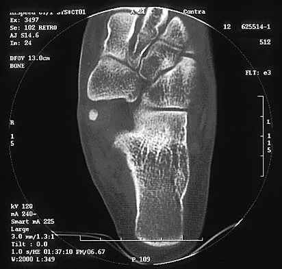 Orthopedic Surgery Board Review 2026 | High-Yield MCQs - Set 8 - Figure 63