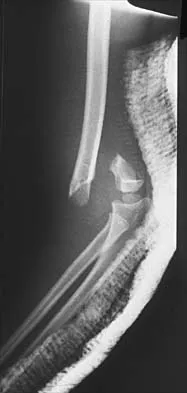 Orthopedic Surgery Board Review 2026 | High-Yield MCQs - Set 8 - Figure 65