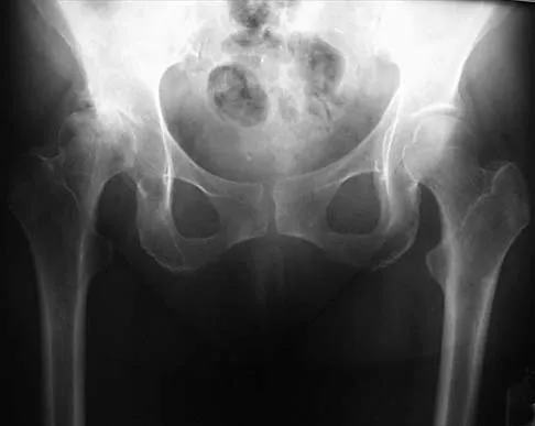 Orthopedic Surgery Board Review 2026 | High-Yield MCQs - Set 8 - Figure 92