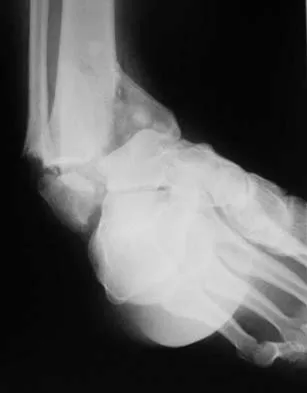 Orthopedic Surgery Board Review 2026 | High-Yield MCQs - Set 8 - Figure 95