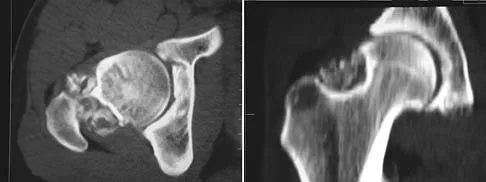 Orthopedic Surgery Board Review 2026 | High-Yield MCQs - Set 8 - Figure 97