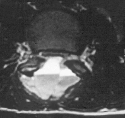 Orthopedic Surgery Board Review 2026 | High-Yield MCQs - Set 9 - Figure 105