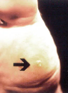 Orthopedic Surgery Board Review 2026 | High-Yield MCQs - Set 9 - Figure 107