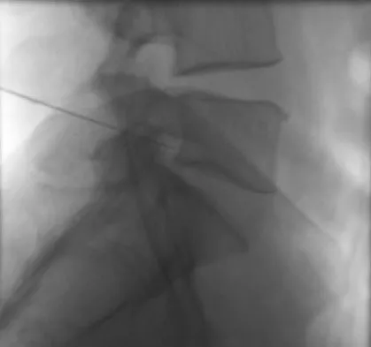 Orthopedic Surgery Board Review 2026 | High-Yield MCQs - Set 9 - Figure 113