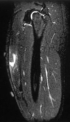 Orthopedic Surgery Board Review 2026 | High-Yield MCQs - Set 9 - Figure 22