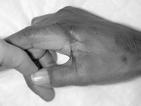 Orthopedic Surgery Board Review 2026 | High-Yield MCQs - Set 9 - Figure 4