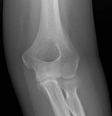 Orthopedic Surgery Board Review 2026 | High-Yield MCQs - Set 9 - Figure 46