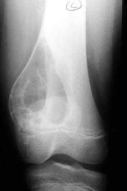 Orthopedic Surgery Board Review 2026 | High-Yield MCQs - Set 9 - Figure 51