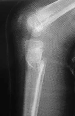 Orthopedic Surgery Board Review 2026 | High-Yield MCQs - Set 9 - Figure 68