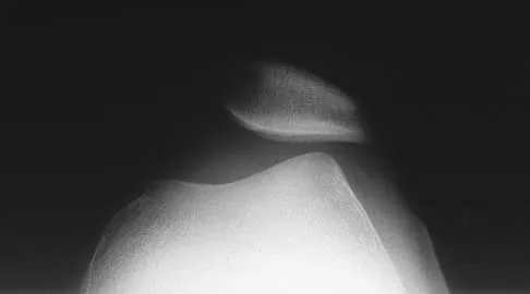 Orthopedic Surgery Board Review 2026 | High-Yield MCQs - Set 9 - Figure 73