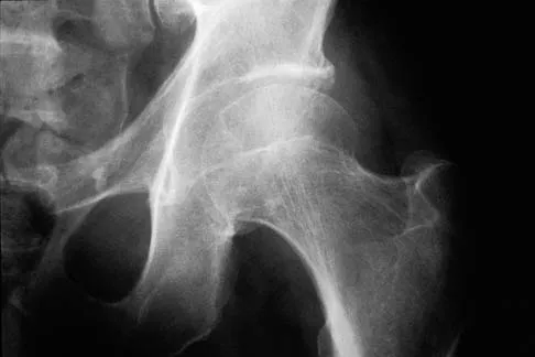 Orthopedic Surgery Board Review 2026 | High-Yield MCQs - Set 9 - Figure 85