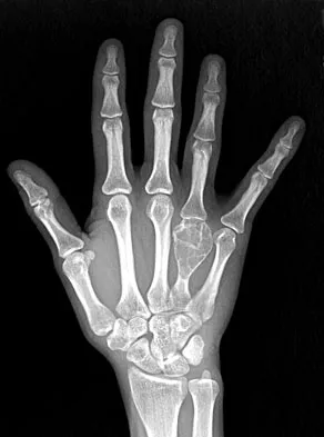 Orthopedic Surgery Board Review 2026 | High-Yield MCQs - Set 9 - Figure 89