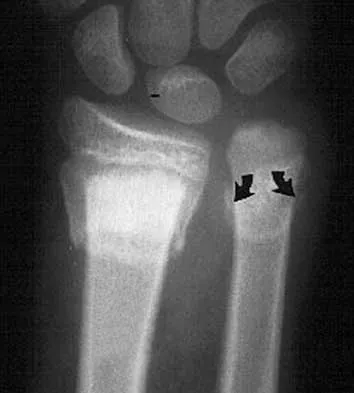 Orthopedic Surgery Board Review 2026 | High-Yield MCQs - Set 9 - Figure 93