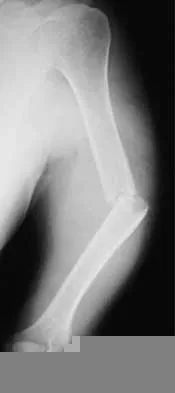 Orthopedic Trauma 2026 MCQs: Board Review Questions & Answers (Part 2) Figure 1