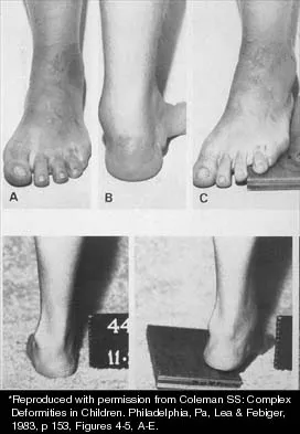 Pediatrics 2001 Practice Questions: Set 1 (Solved) - Figure 10