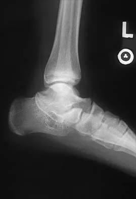 Pediatrics 2001 Practice Questions: Set 1 (Solved) - Figure 12