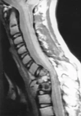 Pediatrics 2001 Practice Questions: Set 1 (Solved) - Figure 21