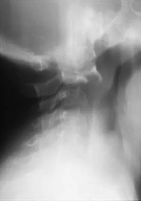 Pediatrics 2001 Practice Questions: Set 1 (Solved) - Figure 26