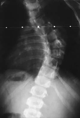 Pediatrics Board Review 2001: High-Yield MCQs (Set 2) - Figure 17