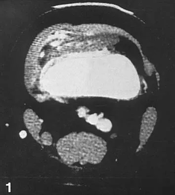 Pediatrics 2001 Practice Questions: Set 3 (Solved) - Figure 13