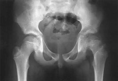 Pediatrics 2001 Practice Questions: Set 3 (Solved) - Figure 17