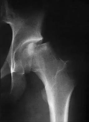 Pediatrics 2001 Practice Questions: Set 3 (Solved) - Figure 25