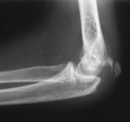 Pediatrics 2001 Practice Questions: Set 3 (Solved) - Figure 26