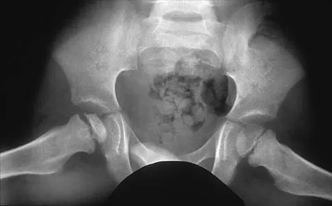 Pediatrics 2001 Practice Questions: Set 3 (Solved) - Figure 5