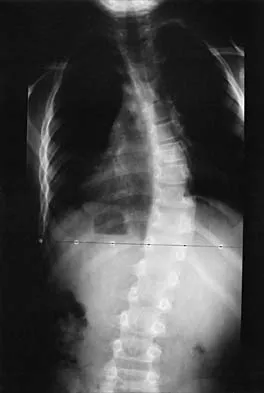 Pediatrics Board Review 2001: High-Yield MCQs (Set 4) - Figure 16