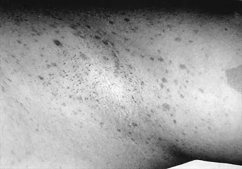 Pediatrics Board Review 2001: High-Yield MCQs (Set 4) - Figure 20