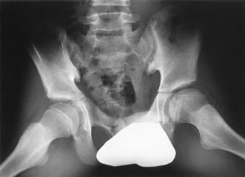 Pediatrics 2004 Practice Questions: Set 1 (Solved) - Figure 23