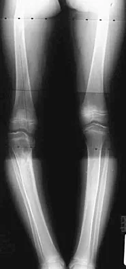 Pediatrics 2004 Practice Questions: Set 1 (Solved) - Figure 8