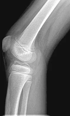 Pediatrics Board Review 2004: High-Yield MCQs (Set 2) - Figure 15