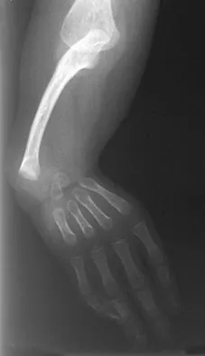 Pediatrics Board Review 2004: High-Yield MCQs (Set 2) - Figure 16