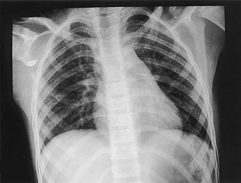 Pediatrics Board Review 2004: High-Yield MCQs (Set 2) - Figure 18