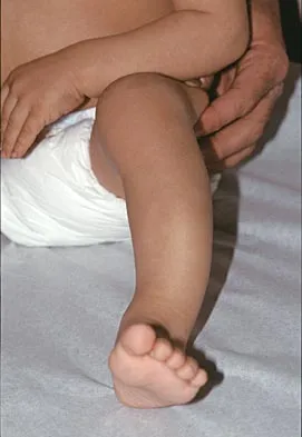 Pediatrics Board Review 2004: High-Yield MCQs (Set 2) - Figure 21