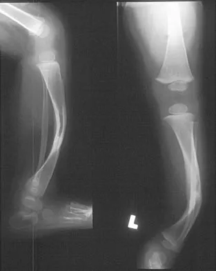Pediatrics Board Review 2004: High-Yield MCQs (Set 2) - Figure 23
