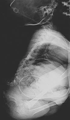 Pediatrics Board Review 2004: High-Yield MCQs (Set 2) - Figure 32
