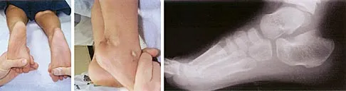 Pediatrics Board Review 2004: High-Yield MCQs (Set 2) - Figure 7