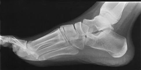 Pediatrics 2004 Practice Questions: Set 3 (Solved) - Figure 17