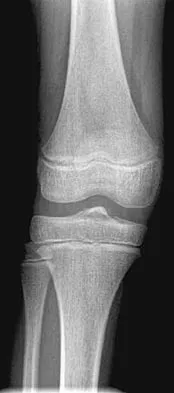 Pediatrics 2004 Practice Questions: Set 3 (Solved) - Figure 20