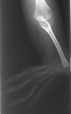 Pediatrics 2004 Practice Questions: Set 3 (Solved) - Figure 22