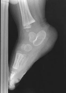 Pediatrics 2004 Practice Questions: Set 3 (Solved) - Figure 25