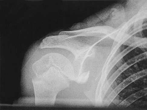 Pediatrics 2004 Practice Questions: Set 3 (Solved) - Figure 27