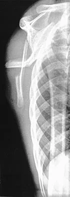 Pediatrics 2004 Practice Questions: Set 3 (Solved) - Figure 28