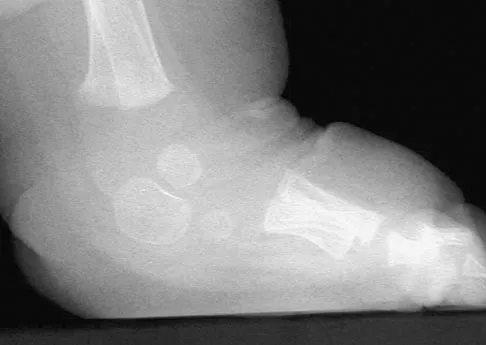 Pediatrics 2004 Practice Questions: Set 3 (Solved) - Figure 30