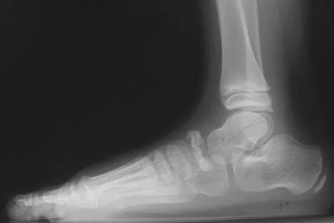 Pediatrics 2004 Practice Questions: Set 3 (Solved) - Figure 4