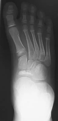 Pediatrics 2004 Practice Questions: Set 3 (Solved) - Figure 5